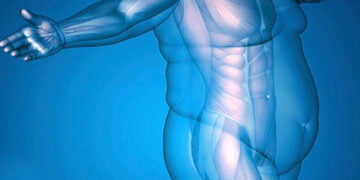 Obezite tedavisinde mide küçültme yeterli mi? – Tuğçe Hürsöz