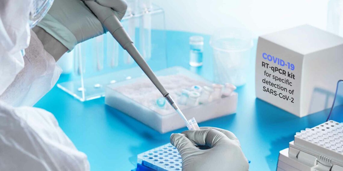 Şov bittiyse gerçekleri konuşalım mı? Ne kadar PCR testi yaptık? – Çağdaş Öğüç