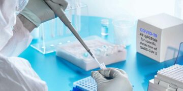 Şov bittiyse gerçekleri konuşalım mı? Ne kadar PCR testi yaptık? – Çağdaş Öğüç