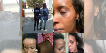 Polisten iki kadına şiddet iddiası