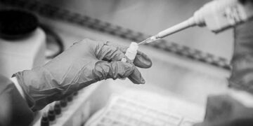 Kıbrıs’ta yeni bir HIV-1 türü keşfedildi