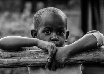 Somali’de 730 çocuk beslenme merkezlerinde öldü