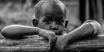 Somali’de 730 çocuk beslenme merkezlerinde öldü